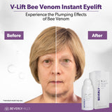 Beverly Hills V-Lift Instant Eye Lift and Eye Tuck Bee Venom Serum for Puffy Eyes, Dark Circles, Wrinkles, and Under Eye Bags Treatment for Women and Men | 30mL (120 Day Supply)