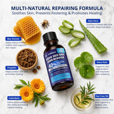 Dr.Johnes Fast-Acting Wart Remover Liquid: 40% Salicylic Acid Maximum Strength Plantar Wart and Corn Remover with Bee Venom for Hands, Feet and Toes