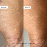 OneSkin BODY OS-01 Peptide Skin Longevity Daily Moisturizer- Improves Skin Texture & Barrier, Safe for Sensitive Skin