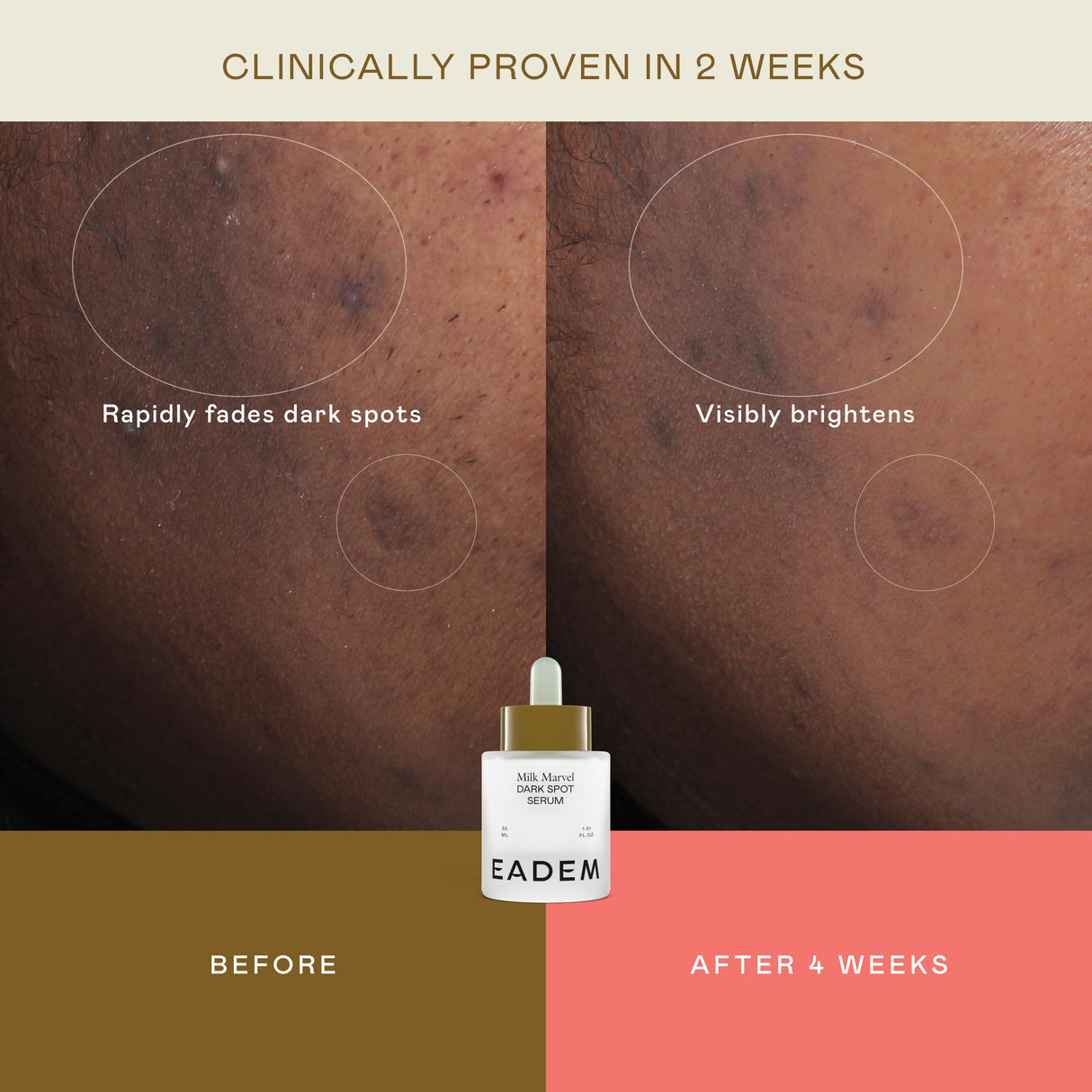 EADEM Milk Marvel Dark Spot Serum, Vitamin C Face Serum Infused with Niacinamide, Dark Spot Remover for Face & Body, Dark Spot Corrector for Skin Care, 1 oz