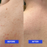 Codex Labs Shaant Clear Skin Supplement – 60 Vegan Capsules | Acne Probiotics with 9-Strain Blend, Green Tea EGCG & Guggul – Daily Support for Acne-Prone Skin & Clear Complexion