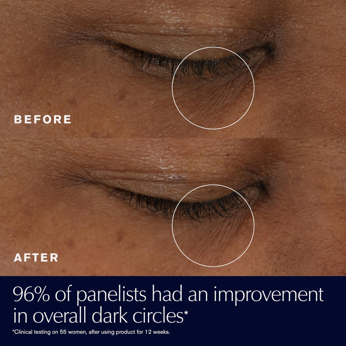 Estée Lauder Advanced Night Repair Eye Supercharged Gel-Cream Synchronized Multi-Recovery | Eye Cream for Dark Circles, 0.5 Fl Oz