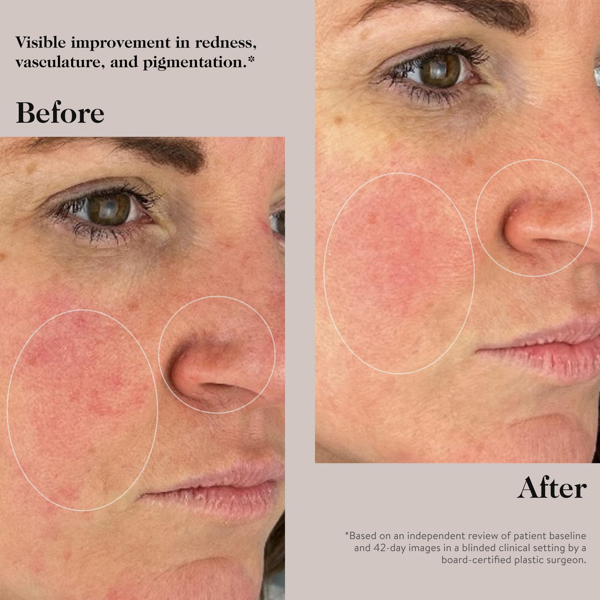 goop Beauty Peptide Serum |Reduces Fine Lines, Wrinkles, & Dark Spots | Peptides, Ceramides, & Niacinamide | Anti Aging Treatment to Improve Firmness & Elasticity | 1 fl oz