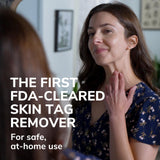 Dr. Scholl's Freeze Away Skin Tag Remover - The First FDA Cleared, at Home Skin tag Removal kit. Clinically Proven Skin tag Removal in as Little as 1 Treatment. 1 Skin tag Removal kit, 8 Treatments.