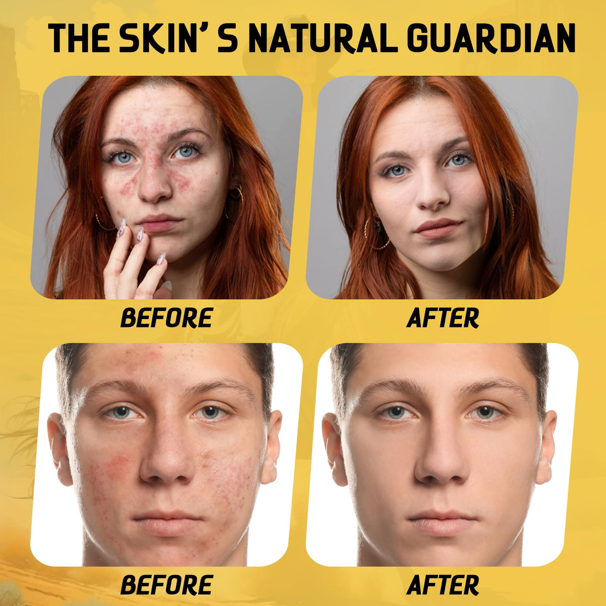 Bull & Beauty Organic Beef Tallow and Honey Balm 7.05oz Organic Beef Tallow for Skin - 100% Grass-Fed Unscented Beef Tallow Moisturizer for Skin & Face with Manuka Honey, Olive Oil & Beeswax