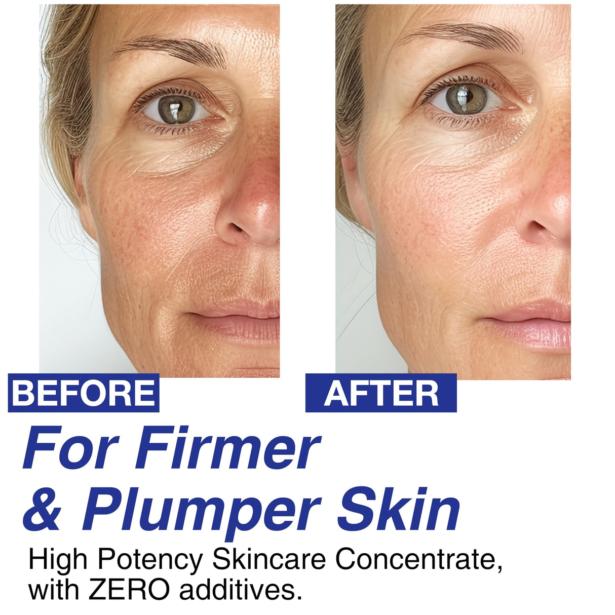 CELDYQUE 100% Pure Volufiline Concentrate Mix-in Serum - Skin Firming Solution & Clinically Proven | Anti-Wrinkle, Enhances Facial Contours, Boosts Collagen for Sagging Mature Skin Korean Skincare