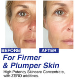 CELDYQUE 100% Pure Volufiline Concentrate Serum 2ea - Skin Firming Solution & Clinically Proven | Anti-Wrinkle, Enhances Facial Contours, Boosts Collagen for Sagging Mature Skin Korean Skincare