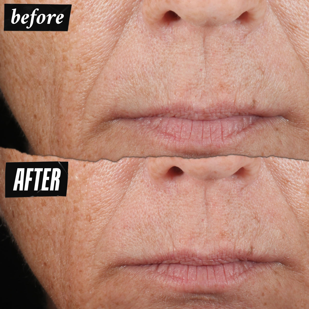 Kiehl's Midnight Recovery Concentrate Moisturizing Face Oil, Lightweight Facial Serum, Restores Skin Radiance Overnight, Reduces Fine Lines, Refines Skin Texture, 99.4% Naturally Derived - 3.4 fl oz