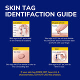 Dr. Scholl's Freeze Away Skin Tag Remover - The First FDA Cleared, at Home Skin tag Removal kit. Clinically Proven Skin tag Removal in as Little as 1 Treatment. 1 Skin tag Removal kit, 8 Treatments.