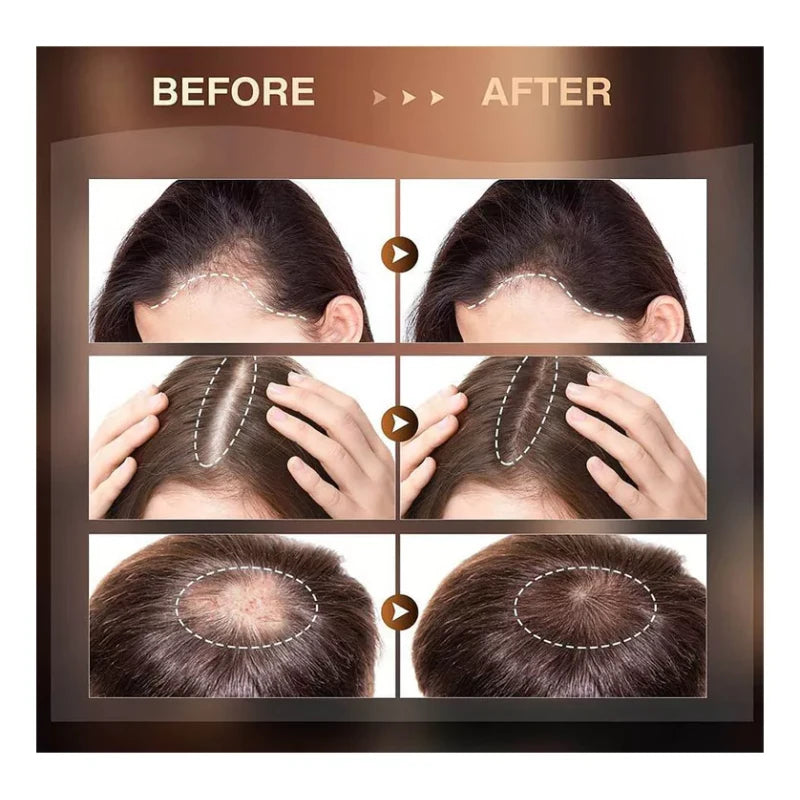 generic 3pzs Sérum Crescimento Capilar Re:act Minoxi Roll-on Hair