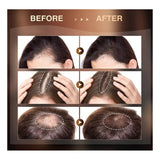 generic 3pzs Sérum Crescimento Capilar Re:act Minoxi Roll-on Hair