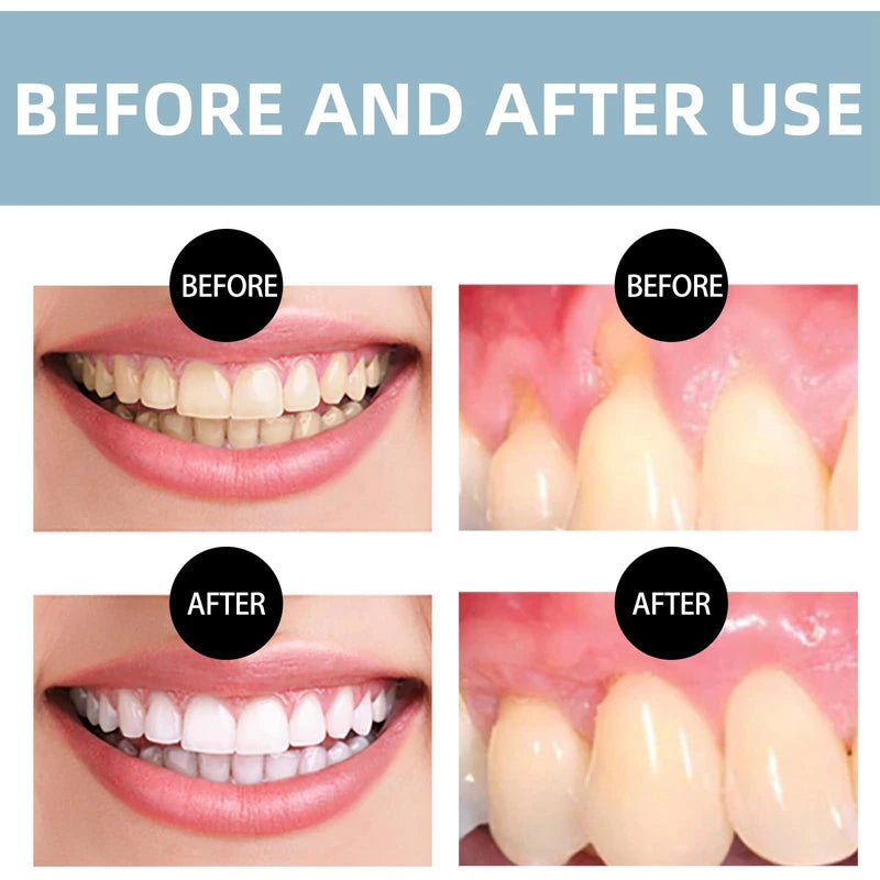 Dentite Cavity Healing Tooth Armor,Dentite Tooth Armor,Cavity Healing Tooth Armor Liquid,Gum Repair for Receding Gums,Bleeding Gums Treatment,Gum Repair,Helps Keep Gum Healthy,Receding Gum Treatment