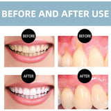 Dentite Cavity Healing Tooth Armor,Dentite Tooth Armor,Cavity Healing Tooth Armor Liquid,Gum Repair for Receding Gums,Bleeding Gums Treatment,Gum Repair,Helps Keep Gum Healthy,Receding Gum Treatment