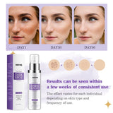 HANYWIL HANYWIL Dark Spot Remover for Face and Body, Dark Spot Corrector Cream, Skin Brown Spot Remover, Skin Care Face Cream, Sun Spot Remover, Age Spot Corrector, Rapid Tone Repair Retinol (1.7 Fl Oz)