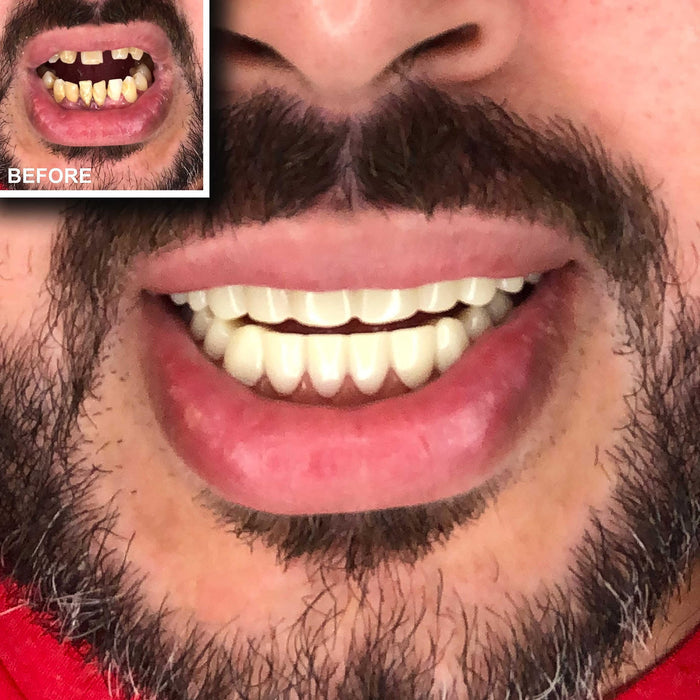 Instant Smile Comfort Fit Flex Teeth - Upper and Lower Matching Set, Natural Shade! Fix Your Smile at Home Within Minutes!
