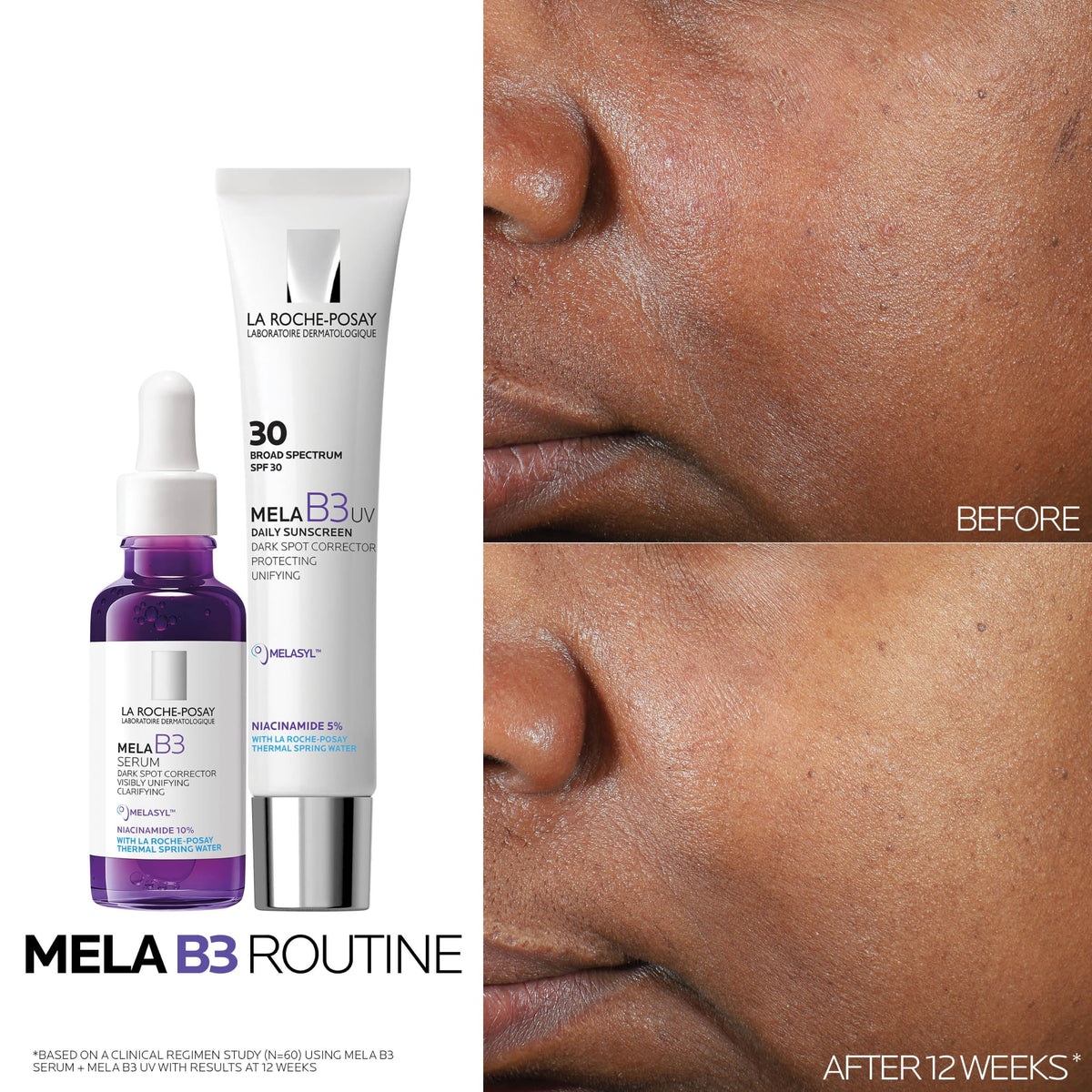 La Roche-Posay Mela B3 Serum, Anti-Aging Dark Spot Corrector, 1 fl oz