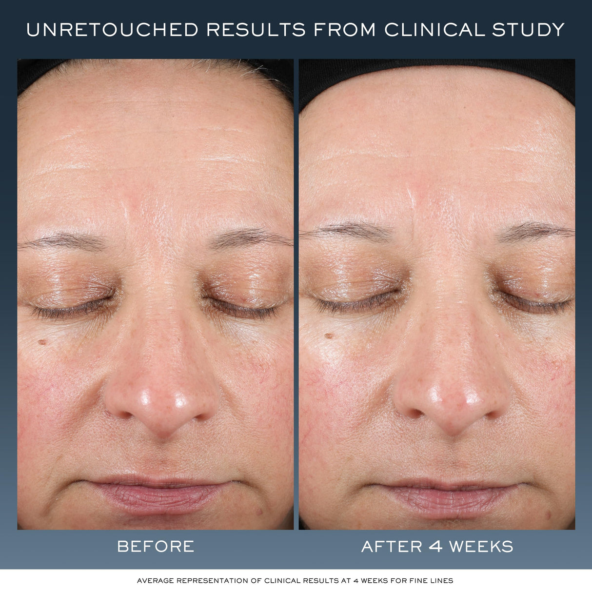 Lancôme Advanced Génifique Night Cream - Repairs Skin Barrier Overnight - With Bifidus Prebiotic, Hyaluronic Acid & Triple Ceramide Complex - 1.7 Fl Oz