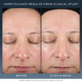 Lancôme Advanced Génifique Night Cream - Repairs Skin Barrier Overnight - With Bifidus Prebiotic, Hyaluronic Acid & Triple Ceramide Complex - 1.7 Fl Oz