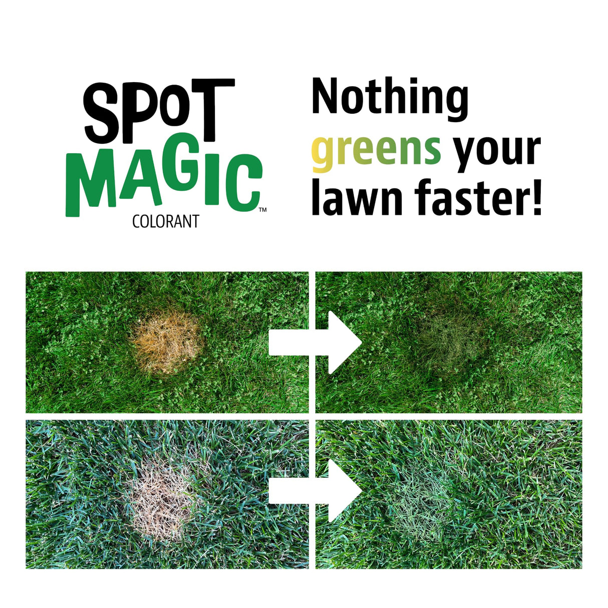 Spot Magic by Mark & Phil’s - Green Instant Lawn Grass Colorant Spray 24oz - Non-Toxic Pet & Kid Safe,- Long-Lasting Results for Concealing Brown & Pet-Damaged Grass Areas