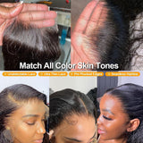 BEEOS 5x5 Skinlike Real HD Lace Closure Only, Pre-plucked Straight Human Hair Closure 0.10mm Ultra-thin Melted Invisible Swiss Lace Small Single Knot 16 Inch