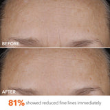 Dr Dennis Gross DermInfusions Blur + Repair Cream, Instantly Blurs Fine Lines, Smooths Skin with Satin-Matte Finish, Visibly Plumps & Firms, Reduces Redness, and Improves Skin Elasticity, 1.7 Fl Oz