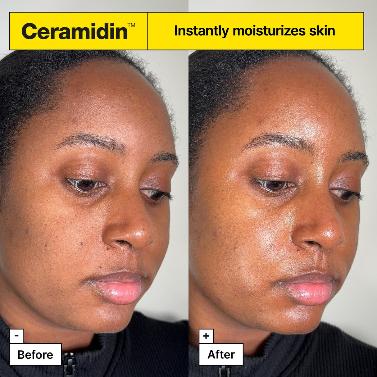 Dr.Jart+ Ceramidin Skin Barrier Moisturizer Face Cream For Dry Skin with Ceramides and Panthenol | Korean Skin Care 2.53 Fl Oz