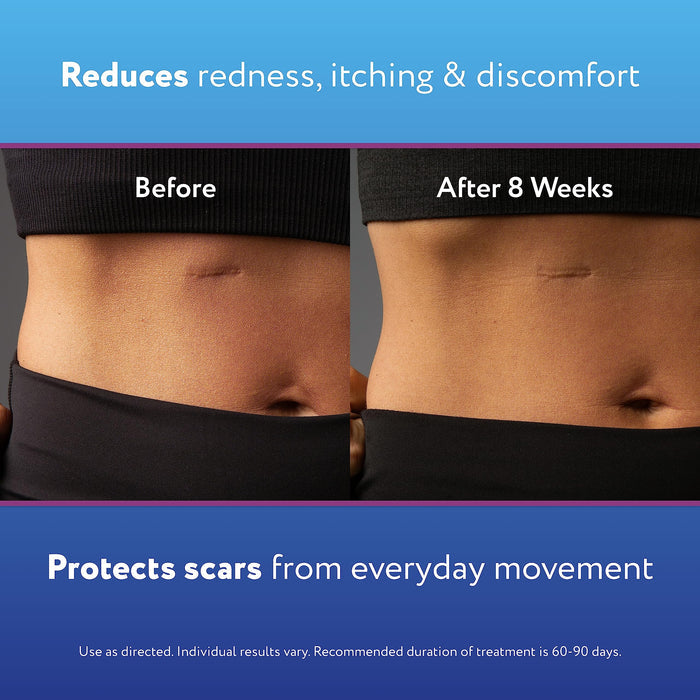 ScarAway Silicone Scar Gel, Helps Improve Size, Color & Texture of Hypertrophic & Keloid Scars from Injury, Burns & Surgery, Water Resistant, 20g (0.7 Oz)