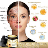 AEEHFENG LOVILDS Bee Venom Cream, Professional Bee Venom Skin Treatment Cream, LOVILDS Bee Venom Repair Cream for All Skin Types (1 Bottle)