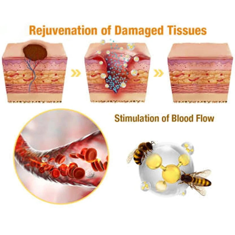 LOVILDS Bee Venom Spray - Remove Spots for Men Women, Bee Venom Spray, Bee Venom Skin Spray for All Parts of the Body (2PCS)