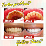 WE2C [SP-5 Probiotic toothpaste], Whitening Toothpaste-Freshens Breath,Fights Plaque - Flavor: red