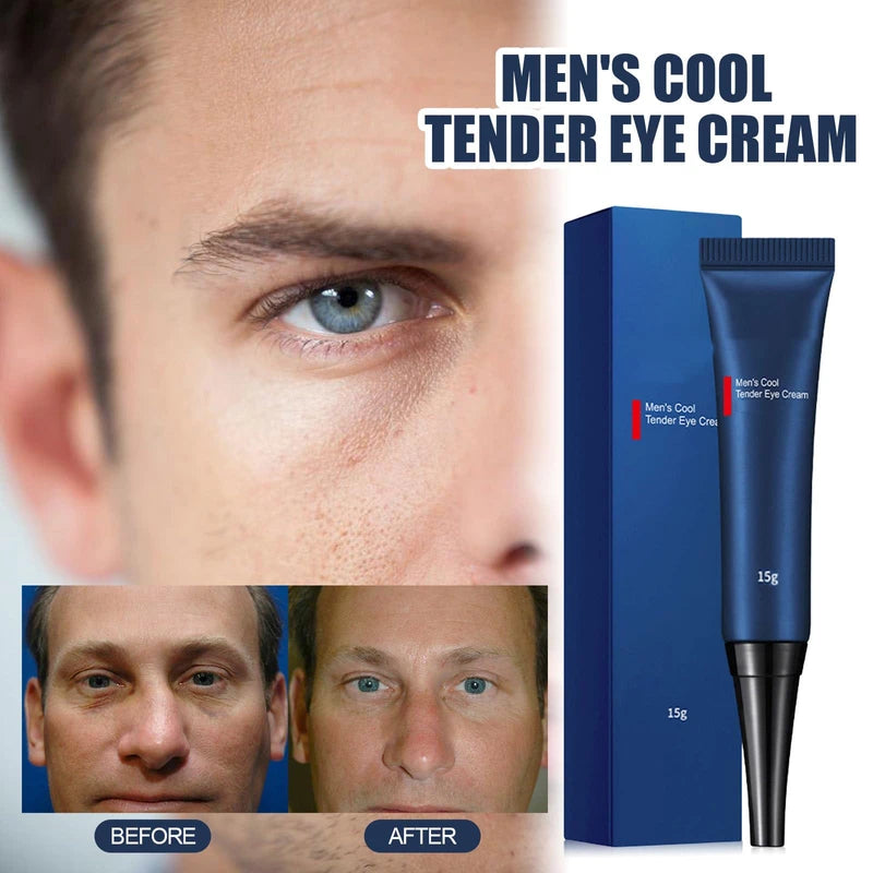 Pemarlis Awaken Peptide Lifting Eye Gel, Openeyes Awaken Peptide Depuffing Eye Gel, Reduces the Appearance of Fine Lines, Rejuvenating Eye Lifting Gel for Men and Women, 15 g, Pack of 3