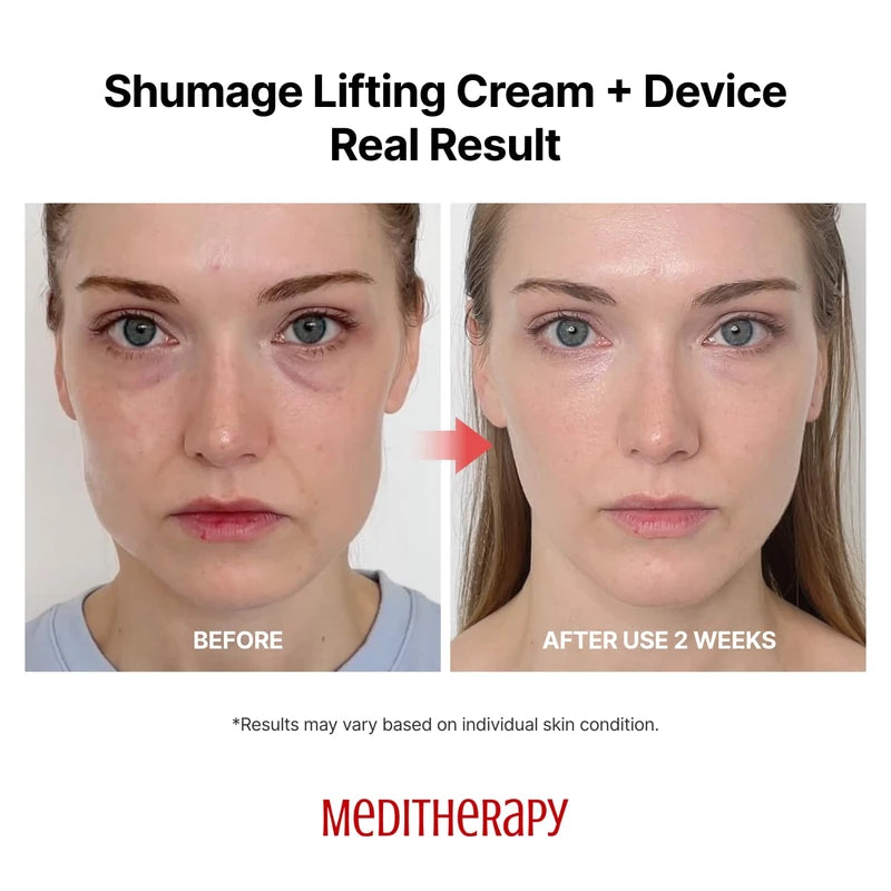 MEDITHERAPY Shumage Gold Seal Lifting Cream+Device, Ultimate Lifting and Tightening for Sagging Skin, Facial Device for Radiant Glow Skin, Elasticity, Anti-Wrinkle