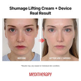 MEDITHERAPY Shumage Gold Seal Lifting Cream+Device, Ultimate Lifting and Tightening for Sagging Skin, Facial Device for Radiant Glow Skin, Elasticity, Anti-Wrinkle