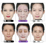 WONDER BATH Super Vegitoks Gel Foam Deep Cleanser for Sensitive Skin [Purple], 10.14Fl.Oz | Makeup Remover, Korean Skincare, Makeup & Dead Skin Removal, Hydrating & Brightening