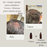 Tonico Vittale Kit 2 Paquete Tónico Y Shampoo Para Cabello Graso | Crecimiento Y Fortalecimiento Capilar | Brillo Y Reconstrucción | 100% Ingredientes Naturales