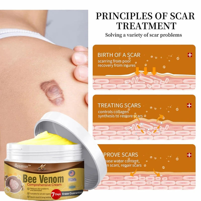 flysmus Bee Venom Comprehensive cream,flysmus Bee Venom Cream, Visibly reduces skin blemishes and smoothes skin (3)