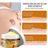 flysmus Bee Venom Comprehensive cream,flysmus Bee Venom Cream, Visibly reduces skin blemishes and smoothes skin (3)