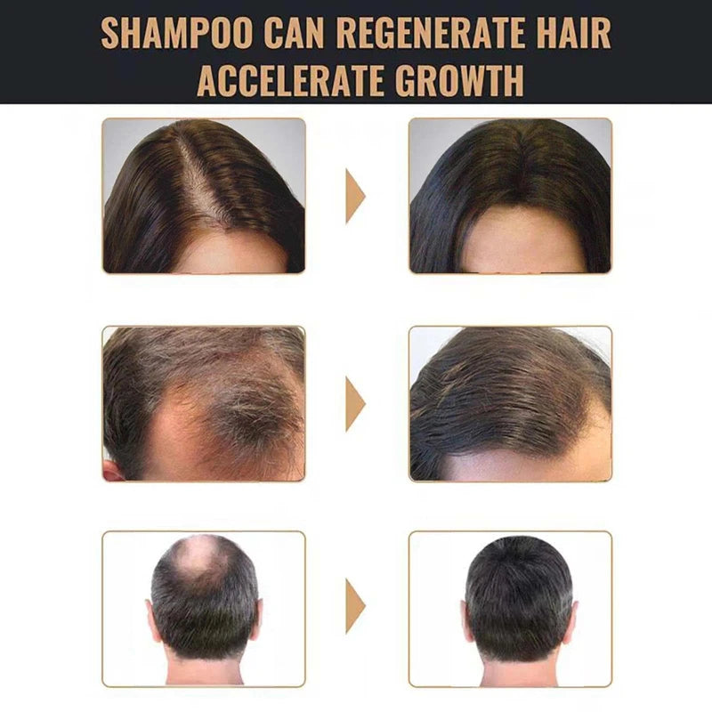 Mane Shampoo for Men & Hair Thickening Shampoo for Men and Women - Reduces Grey Hair, Promotes Natural Darkening & Thinning Hair, Stimulates Hair Regrowth, and Prevents Hair Loss