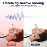 Anti Snoring Device,Electric Stop Snoring Solution,Adjustable Wind Speed Breathable Snoring Prevention for Men Women,Universal All Nose Shapes(White)