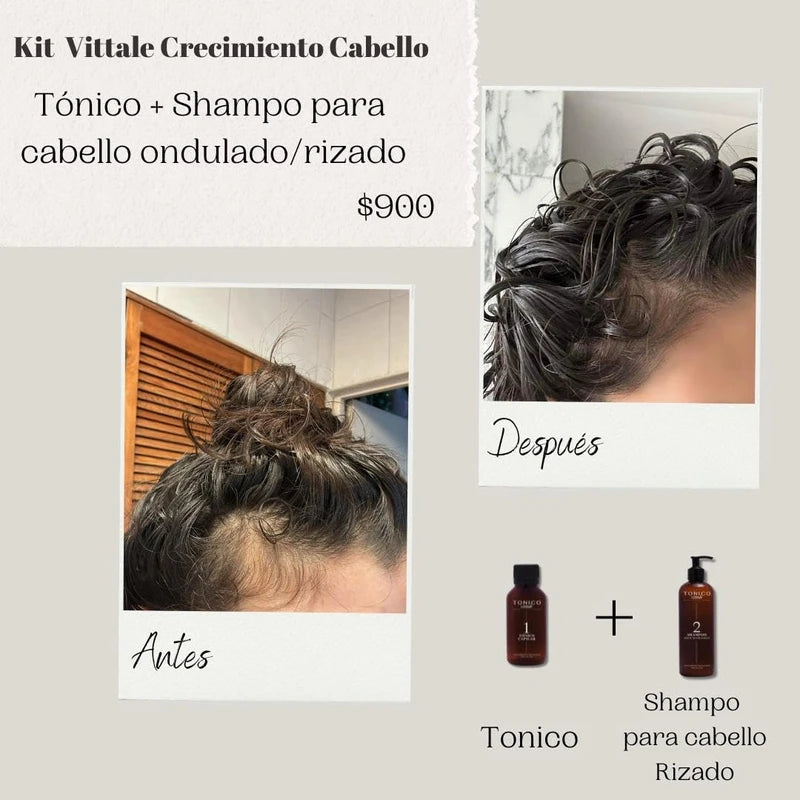 Tonico Vittale Kit 2 Paquete Tónico Y Shampoo Para Cabello Rizado| Unisex | Paso 1 y 2 | Crecimiento Y Fortalecimiento Capilar | Brillo Y Reconstrucción | Control del Frizz | 100% Ingredientes Naturales