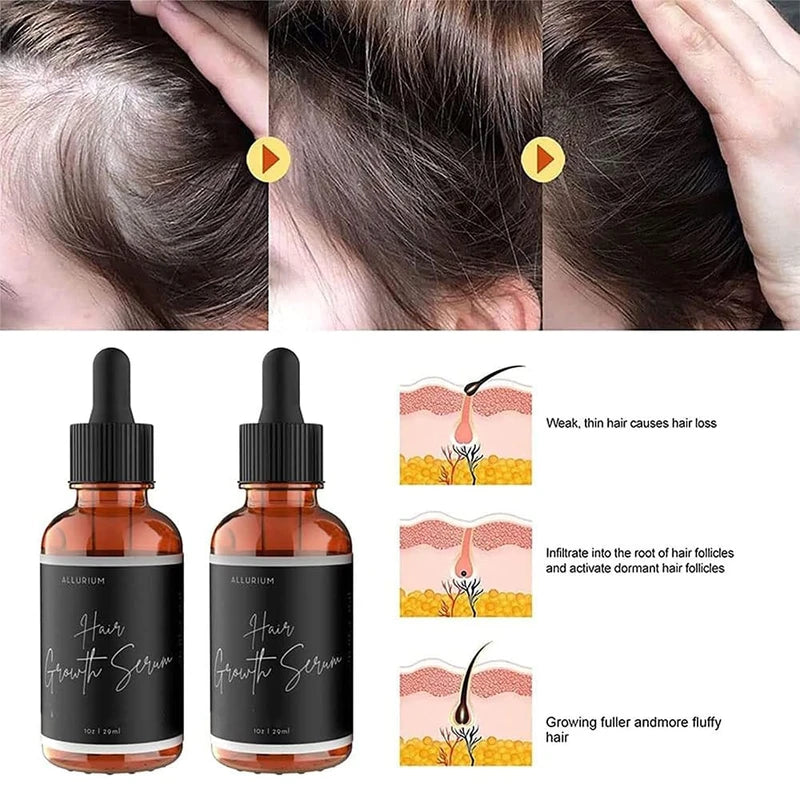 FIONEL Allurium Hair Growth Serum Designed for Black Women with Herbs and Natural Vitamin (4 Pack)