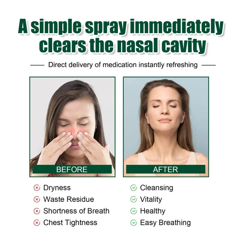 Unbranded Organic Herbal Lung Cleanse & Repair Nasal Spray Pro-30ml