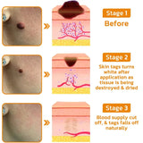 AEEHFENG LOVILDS Bee Venom Cream, Professional Bee Venom Skin Treatment Cream, LOVILDS Bee Venom Repair Cream for All Skin Types (1 Bottle)