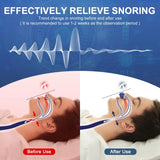 Electric Anti Snoring Device,Stop Snoring Solution,Adjustable Wind Speed Anti Snoring Devices,Breathable Snoring Prevention for Men Women,Universal All Nose Shapes (Blue)