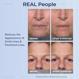 Plexaderm Rapid Reduction Eye Serum - Advanced Formula Anti Aging Visibly Reduces Under-Eye Bags, Wrinkles, Dark Circles, Fine Lines & Crow's Feet Instantly Instant Wrinkle Remover for Face