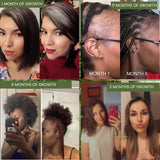 (2-Pack) 10 in 1 Hair Growth Oil (2 Oz) | Formulated With African Chebe Powder For Extreme Hair Growth, 2 Fl Oz (Pack of 1), 2.0 ounces