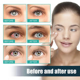 Vision Enhance Roller Medilisk,Cooling Roll-On Applicator for Tired Eyes,Eye Strain Relieve,Eye Massage Roller,Enhances Visual Clarity,Eye Roller Serum,Medilisk Vision Roller,Promotes Relaxation