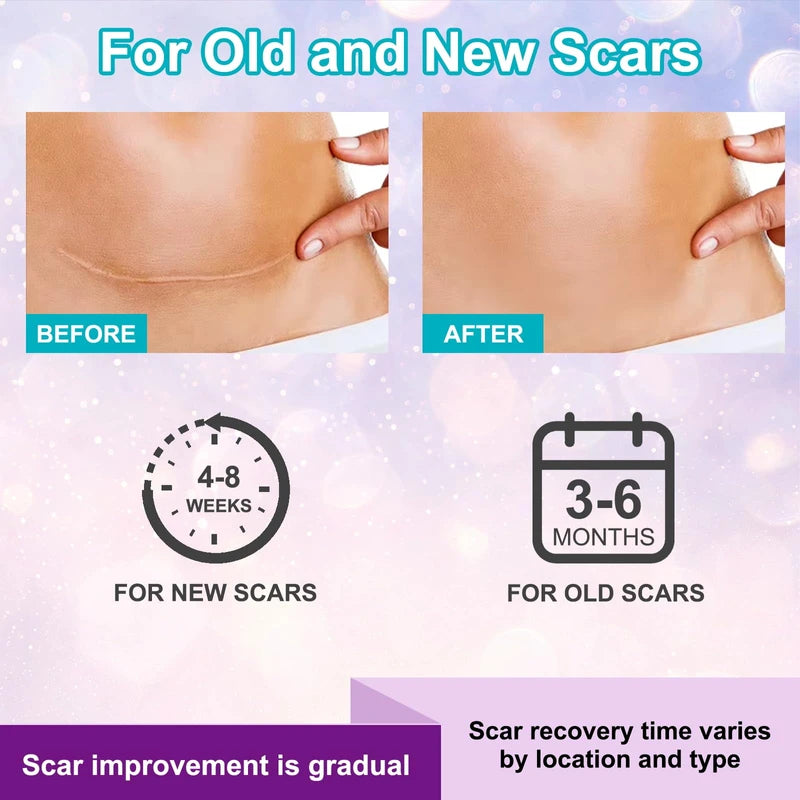 Kelinul Silicone Scar Sheets(1.6 x 120"Roll-3M) Scar Removal Silicone Scar Tape for Softening and Flattening Scars, Acne, C-Section, Keloid Surgery, Painless Removal, Reusable, Washable, 10-12 Month Supply