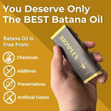 BIONPLEX 100% Organic Hair Growth Serum For Thinning Hair Loss - More Bottles:: 3 Pics