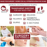 Physician Formulated Silicone Scar Gel Semi-Solid Sheeting - Advanced Crosspolymer Medical Grade Liquid Sheeting for Face, Body, Surgery, C Section, Burn, Keloidal & Hypertrophic Scars | HealFast